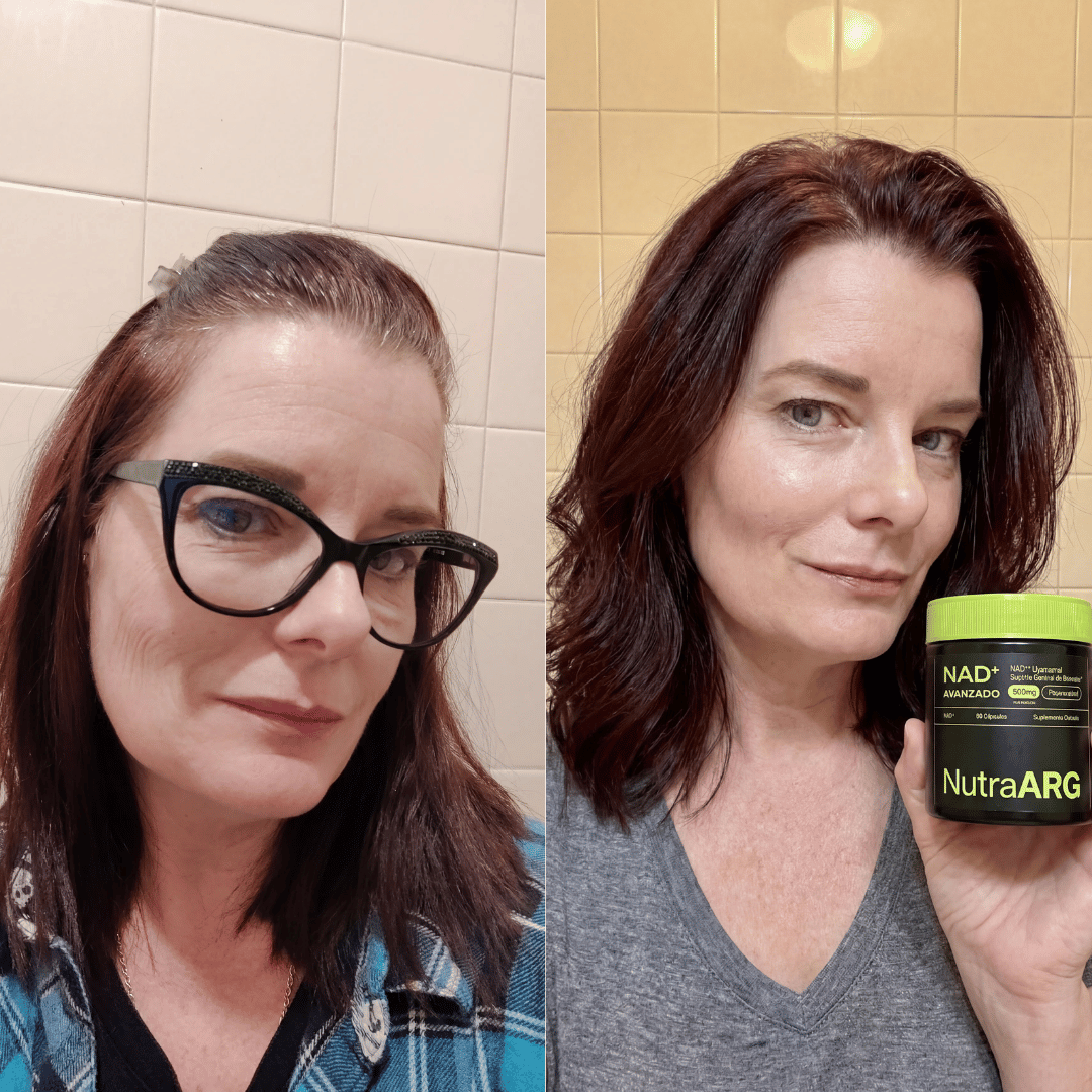 NAD+ Liposomal: Lucí y Sentite 10 Años Más Joven, Sin Botox
